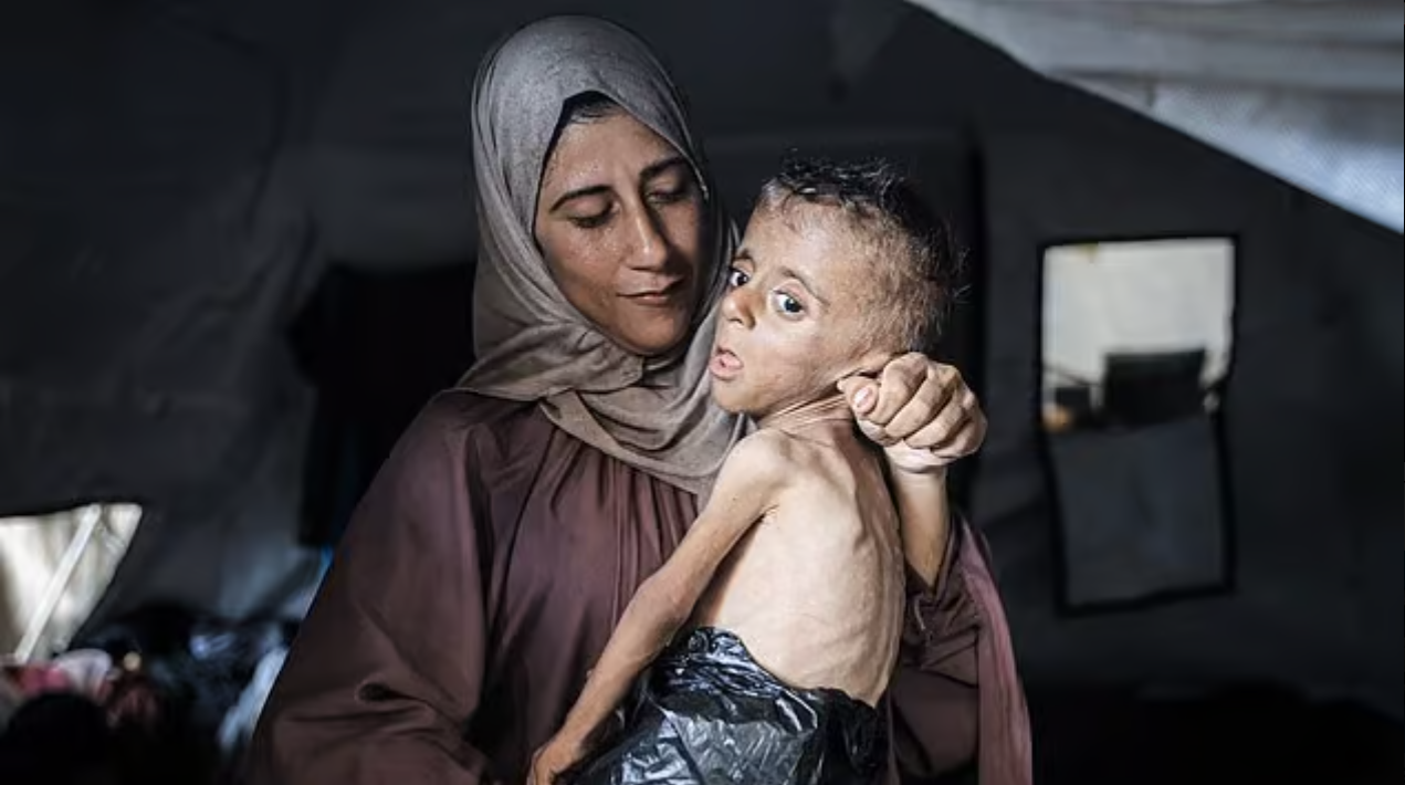 NYT Issues Quiet Correction After Gaza Toddler Image Proven Misleading